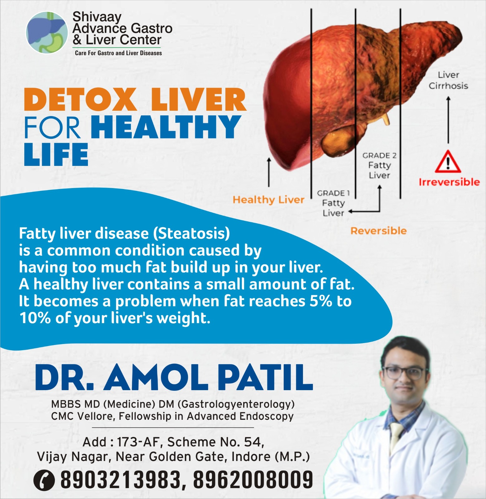 Best Doctor for Liver Disease Treatment in Indore